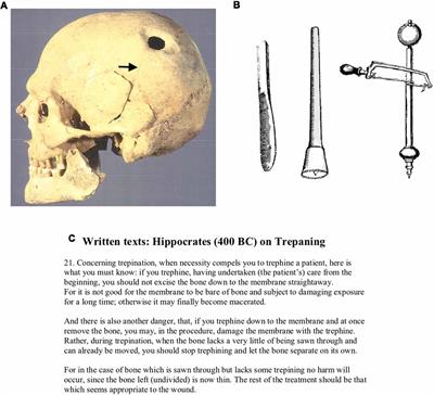 Why Study the History of Neuroscience?